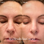 Varita de cuidado facial 4 en 1